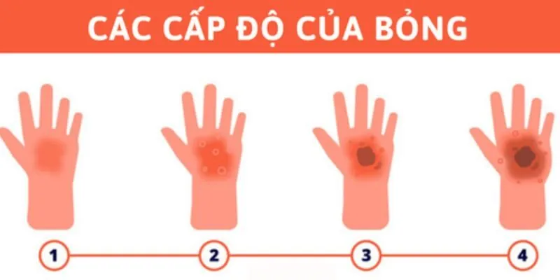 Các vết bỏng