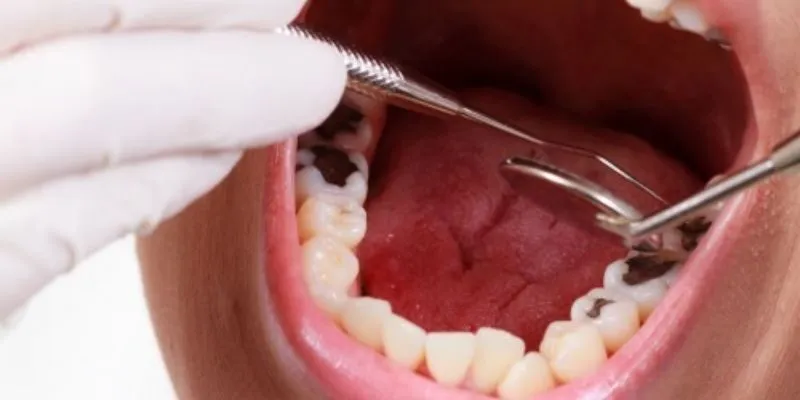 Điều trị sau can thiệp nha khoa